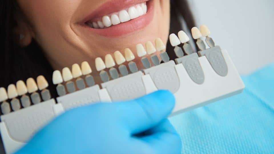 כתרים דנטליים בשיקום שיניים